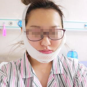 膨体垫下巴 变美