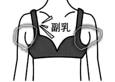 青岛中亚整形医院副乳切除优点 做个性感女人