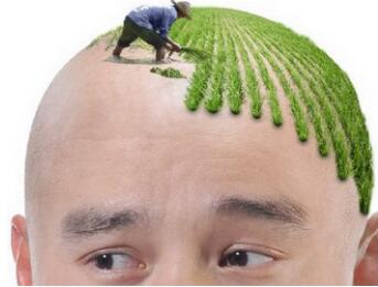 广州植发哪里好 广州植德植发医院头发种植果能保持多久