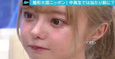 日本女孩Meru为变芭比娃娃 花费了600万日元整容