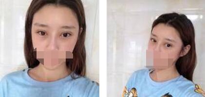 眼睛漂亮起来穿上仙女裙 我就是整条街上较美的妞！