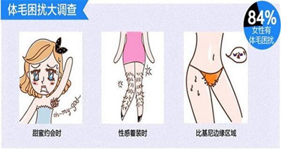 重庆莱森整形激光脱毛费用多少 2020重庆激光脱毛