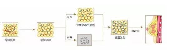 女性的隐秘话题：按摩胸部也能够变大？让胸部变大的方法在这里