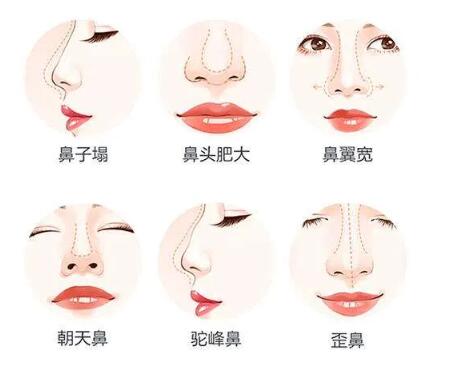 鼻子的美可是至关重要 看看这些需要改良的鼻子