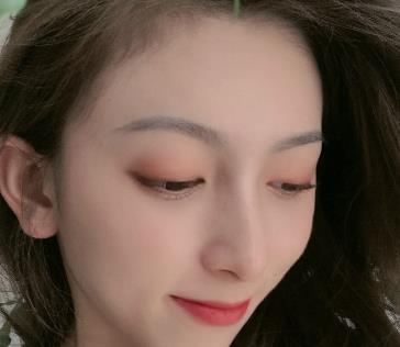 美女在松原花都美容院割双眼皮，两个月后很喜欢