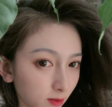 美女在松原花都美容院割双眼皮，两个月后很喜欢