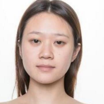 西京医院整形科隆鼻介绍，求美者的术后反馈