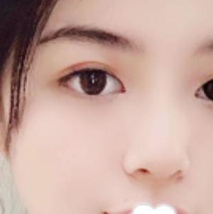 北京赵延勇医生口碑好吗？双眼皮介绍果公布
