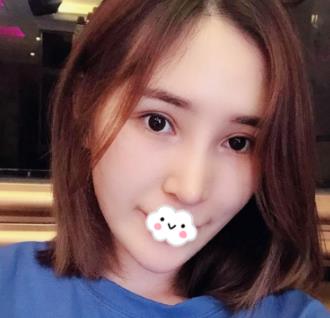 上海gk整形医院做鼻子恢复，两个月的护理变气质宝宝