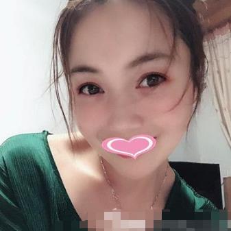 成都西区医院抽脂怎么样？含2020整形（费用标准）