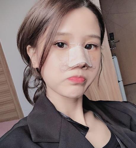 浙医二院隆鼻怎么样？介绍在线反馈，抢一波福利