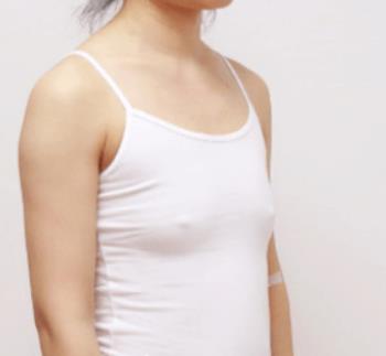穆大力隆胸收费标准是多少？有介绍果和价格参考吗？