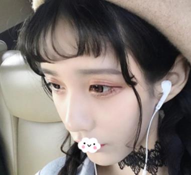 北京301郭伶俐做鼻子好不好？术后一年恢复记录