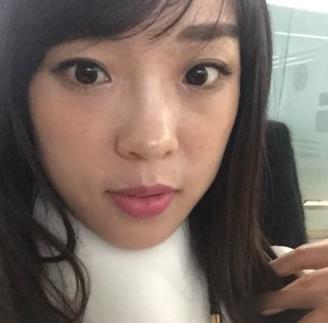 齐鲁医院美容科祛斑怎么样？医生介绍_前后介绍展示