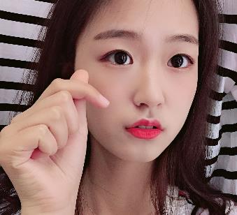 上海九院马刚好不好？面部脂肪填充给你评价