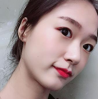上海九院马刚好不好？面部脂肪填充给你评价