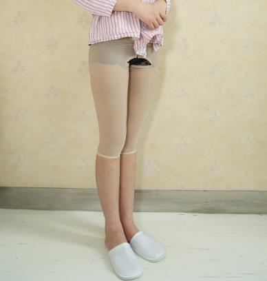 重庆铂生医院杜亚旭医生的大腿抽脂介绍，3个月了大腿很细