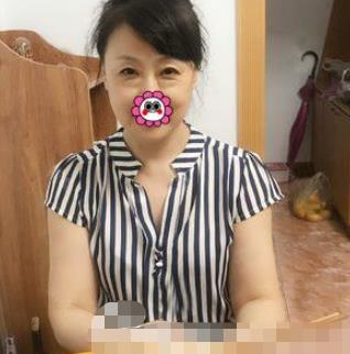 哈尔滨211医院美容科去眼袋介绍