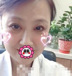 哈尔滨211医院美容科去眼袋介绍