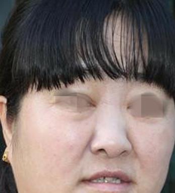 贵州人民医院美容科祛斑介绍，手术项目费用（价格）咨询