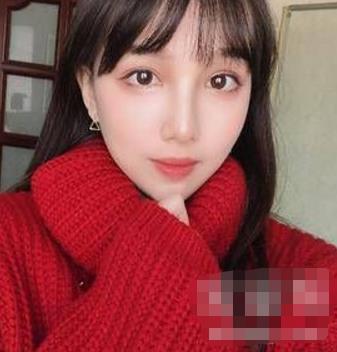 张笑天医生磨骨怎么样？介绍果证实专家的技术很
