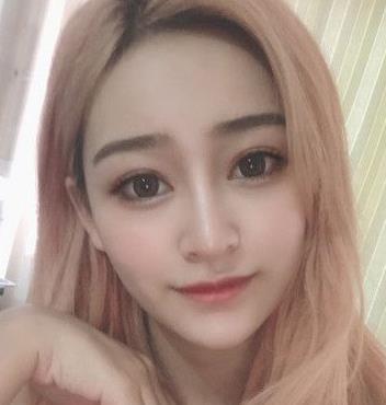 上海九院整形外科曹卫刚脂肪面部填充介绍分享，靠实力说话！