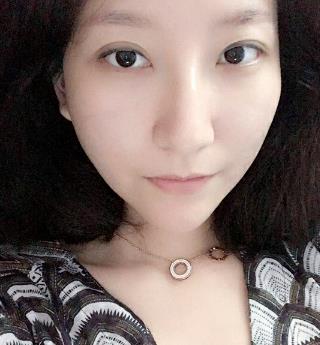 南京亚韩整形医院激光美肤后果，小姐姐至少年轻10岁