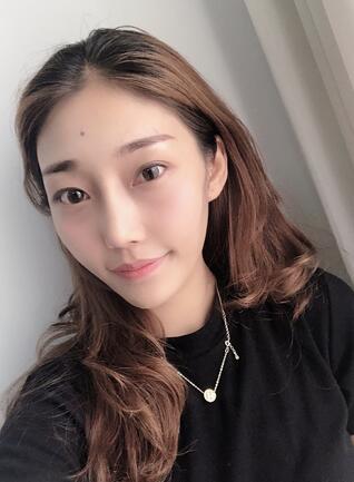 西南医科大学附属医院整形科硅胶垫下巴+膨体隆鼻部手术手术果一览