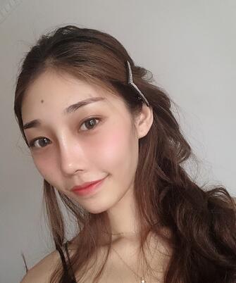 西南医科大学附属医院整形科硅胶垫下巴+膨体隆鼻部手术手术果一览