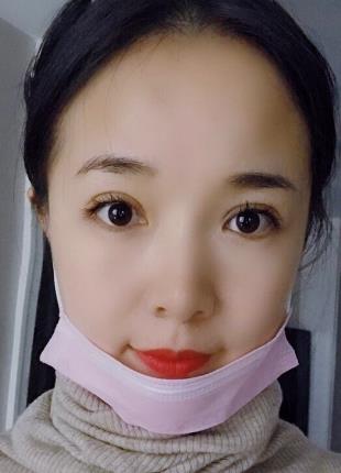 上海美立方整形医院双眼皮怎么样?附手术果记录