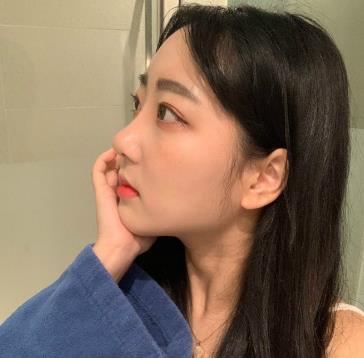 浙医二院整形科隆鼻怎么样？术后介绍果