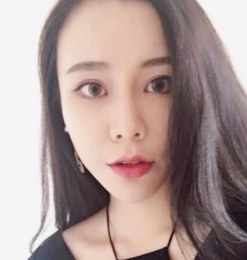 北京玉之光王明利医生面部脂肪填充介绍反馈！