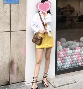 山东省立医院整形科高峰大腿吸脂如何？介绍分享