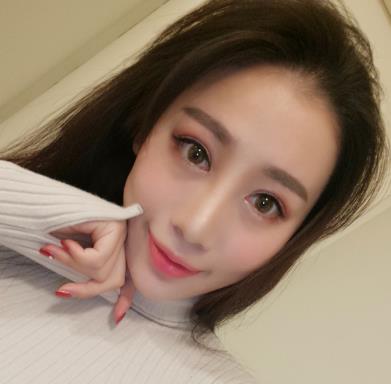 哈尔滨欧华整形医院玻尿酸丰太阳穴恢复介绍欣赏