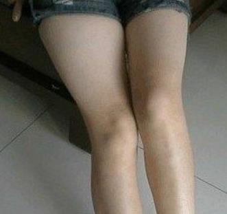 河北医科大学医院美容整形科去疤痕介绍口碑