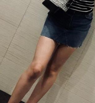 河北医科大学医院美容整形科去疤痕介绍口碑