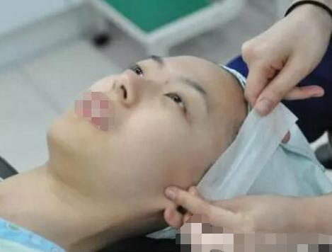 西安西京医院刘超华怎么样？看医生眼鼻部手术整形术恢复经历