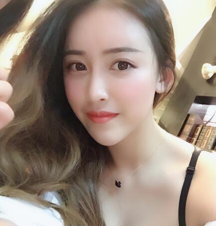 长沙卓而美怎么样?做双眼皮术后一个月的恢复果照