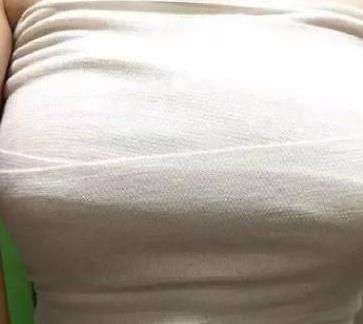 上海九院曹卫刚抽脂隆胸怎么样？介绍及一览