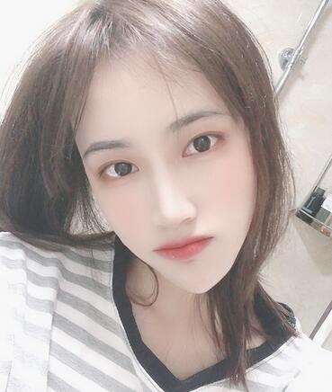 宜宾市第一人民医院整形美容外科隆鼻介绍展示，恢复记录给你看