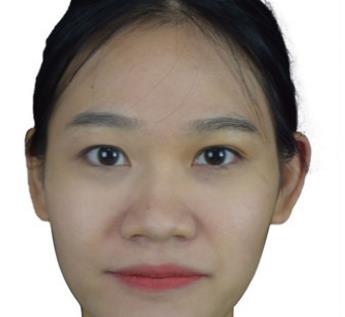 上海九院鼻部手术介绍，五官立体颜值没的说！
