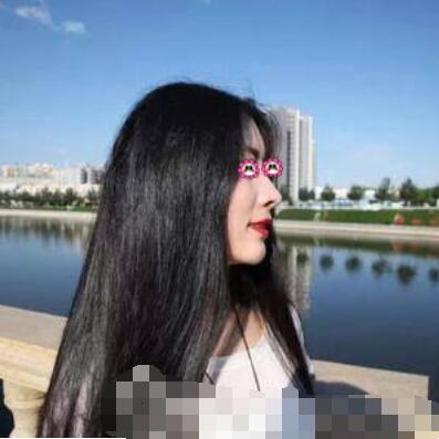 郑大一附院整形外科隆鼻咋样?介绍果和价格费用一览