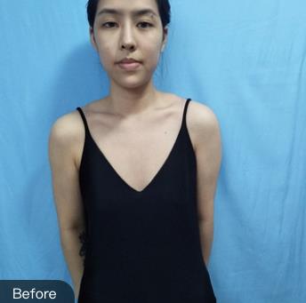 北京韩啸棉花糖丰胸靠谱吗？介绍欣赏，瞧瞧医生实力
