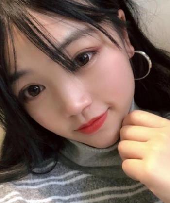 北京八大处靳小雷医生双眼皮果如何？介绍背后是无尽的自信！