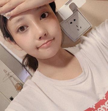 上海华美双眼皮和隆鼻同时做，一起来看看术后果吧！