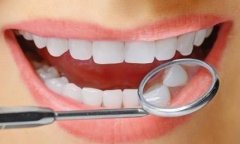 牙齿美白的方法有哪些？什么导致牙齿变黄？