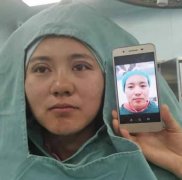 湖南省人民医院做双眼皮怎么样?2021全新案例术后果反馈