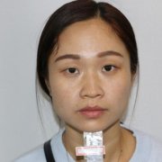 深圳北大医院整形科做双眼皮怎么样？案例及价格表（多少钱）在线参考
