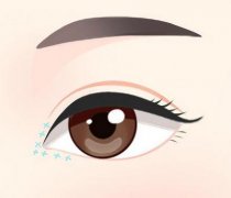 开眼角会影响视力吗?开眼角会留下伤疤吗?