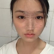 重庆哪个医院隆鼻技术好？推荐重庆时光（含案例和价格查询）